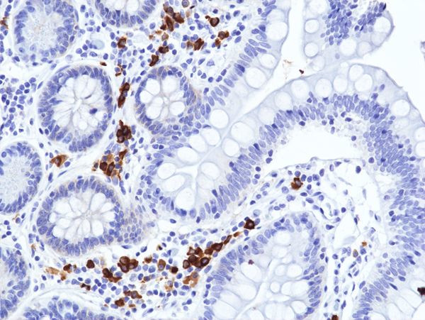 Human IgA (Heavy chain) Antibody in Immunohistochemistry (Paraffin) (IHC (P))