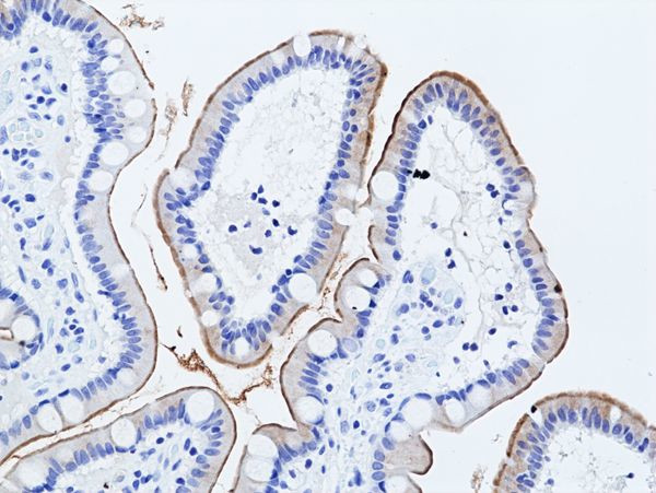 MUC17 Antibody in Immunohistochemistry (Paraffin) (IHC (P))