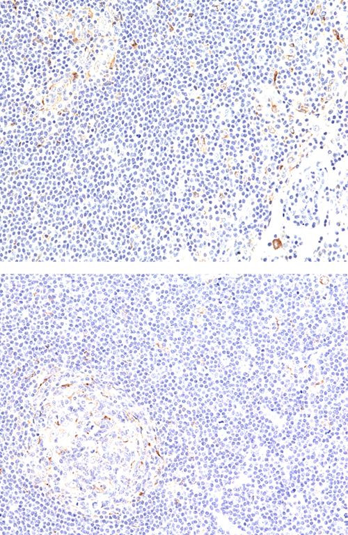 CD137 Antibody in Immunohistochemistry (Paraffin) (IHC (P))