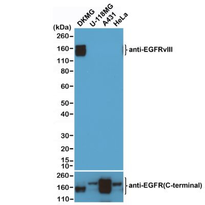 EGFRvIII Antibody in Western Blot (WB)