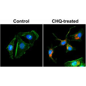 LC3B Antibody in Immunocytochemistry (ICC/IF)