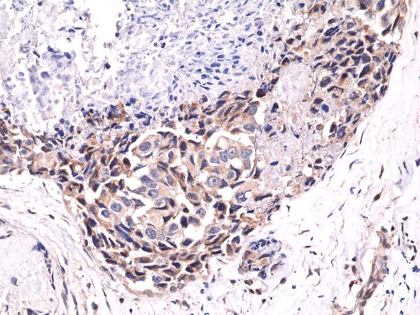 Phospho-AKT Pan (Ser473) Antibody in Immunohistochemistry (Paraffin) (IHC (P))