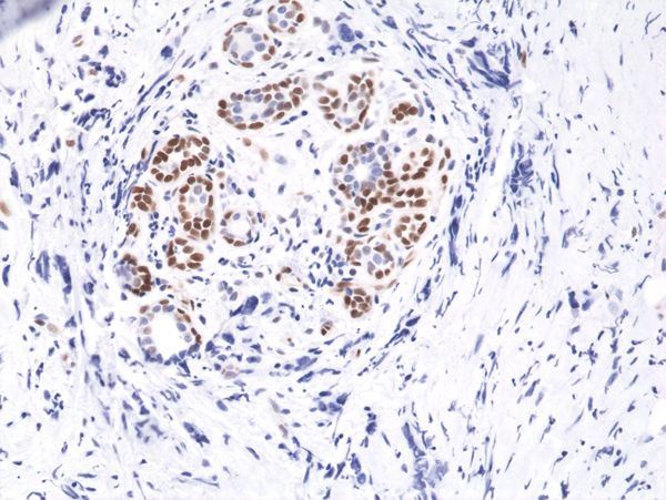 Phospho-STAT3 (Tyr705) Antibody in Immunohistochemistry (Paraffin) (IHC (P))