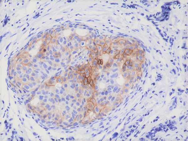 Phospho-EGFR (Tyr1173) Antibody in Immunohistochemistry (Paraffin) (IHC (P))