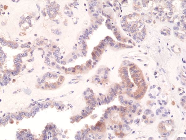 Phospho-EIF2S1 (Ser51) Antibody in Immunohistochemistry (Paraffin) (IHC (P))