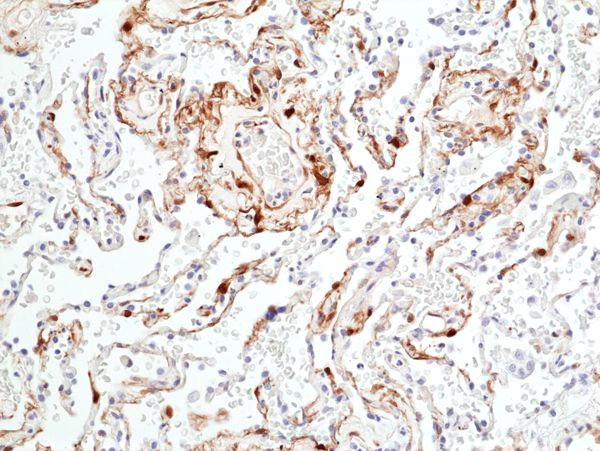 Phospho-ERK1/2 (Thr202, Tyr204) Antibody in Immunohistochemistry (Paraffin) (IHC (P))