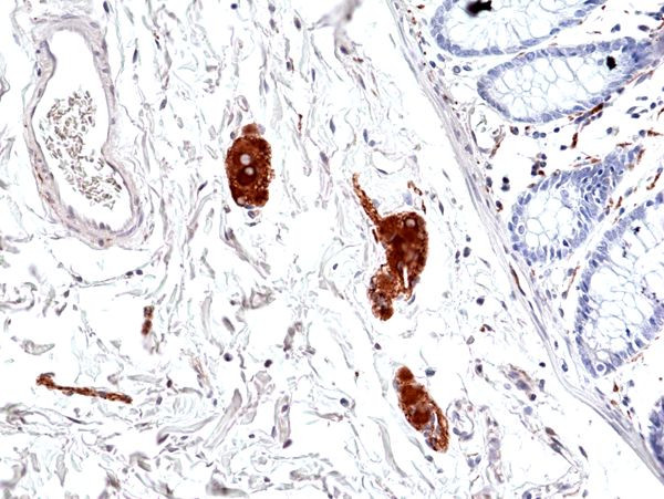 Phospho-Tau (Ser396) Antibody in Immunohistochemistry (Paraffin) (IHC (P))