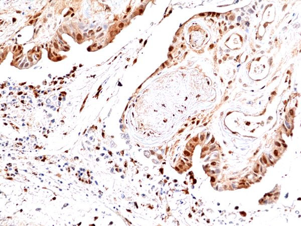 Phospho-JNK1/JNK2/JNK3 (Thr183, Tyr185) Antibody in Immunohistochemistry (Paraffin) (IHC (P))