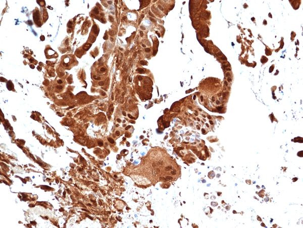 ERK1 Antibody in Immunohistochemistry (Paraffin) (IHC (P))