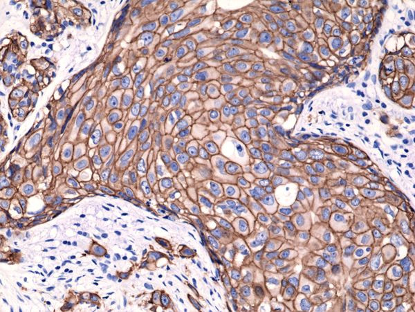 ErbB2 (HER-2) Antibody in Immunohistochemistry (Paraffin) (IHC (P))