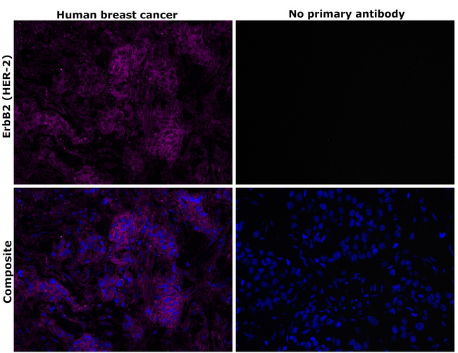 ErbB2 (HER-2) Antibody in Immunohistochemistry (Paraffin) (IHC (P))