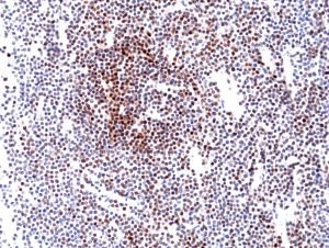 Cyclin D1 Antibody in Immunohistochemistry (Paraffin) (IHC (P))
