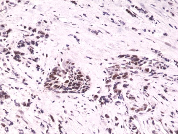 HIF1A Antibody in Immunohistochemistry (Paraffin) (IHC (P))