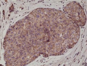 E-cadherin Antibody in Immunohistochemistry (Paraffin) (IHC (P))