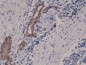 CD146 Antibody in Immunohistochemistry (Paraffin) (IHC (P))