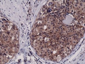 Caspase 3 Antibody in Immunohistochemistry (Paraffin) (IHC (P))
