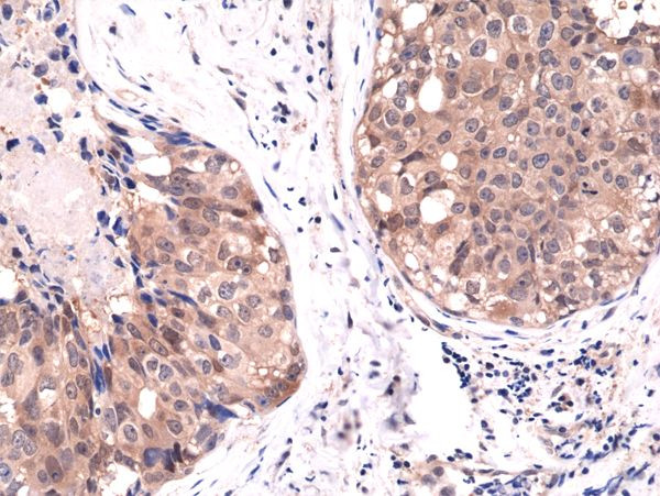 AKT1 Antibody in Immunohistochemistry (Paraffin) (IHC (P))