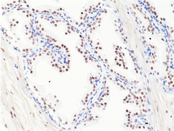 Androgen Receptor Antibody in Immunohistochemistry (Paraffin) (IHC (P))