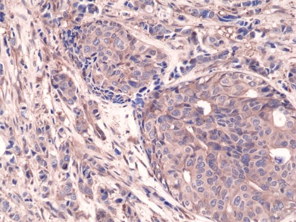 NFkB p65 Antibody in Immunohistochemistry (Paraffin) (IHC (P))