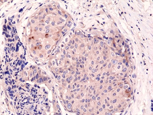 mTOR Antibody in Immunohistochemistry (Paraffin) (IHC (P))