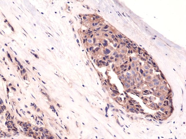 beta Catenin Antibody in Immunohistochemistry (Paraffin) (IHC (P))
