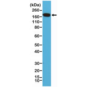 EGFR Antibody in Western Blot (WB)