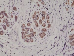 S100B Antibody in Immunohistochemistry (Paraffin) (IHC (P))