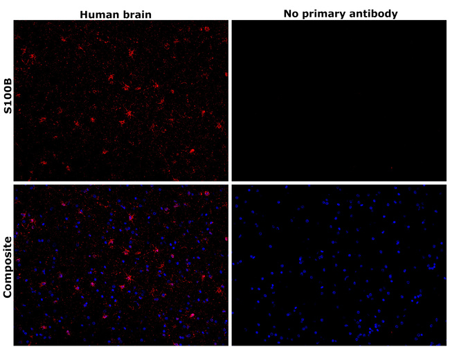 S100B Antibody in Immunohistochemistry (Paraffin) (IHC (P))
