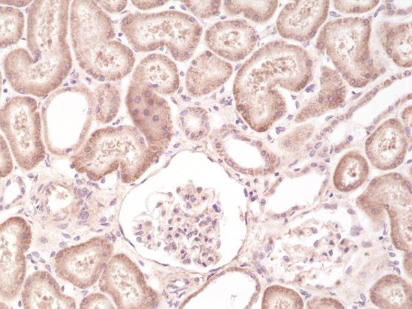 B-Raf Antibody in Immunohistochemistry (Paraffin) (IHC (P))