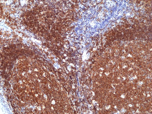 CD19 Antibody in Immunohistochemistry (Paraffin) (IHC (P))