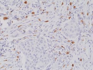 c-Kit Antibody in Immunohistochemistry (Paraffin) (IHC (P))