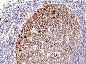 Ki-67 Antibody in Immunohistochemistry (Paraffin) (IHC (P))