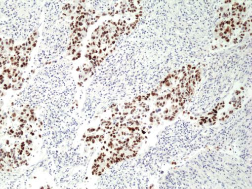 p53 Antibody in Immunohistochemistry (Paraffin) (IHC (P))
