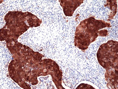 p16INK4a Antibody in Immunohistochemistry (Paraffin) (IHC (P))