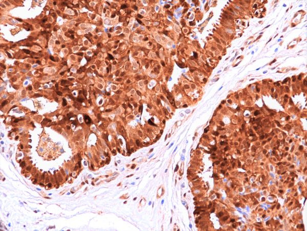 HSP70 Antibody in Immunohistochemistry (Paraffin) (IHC (P))