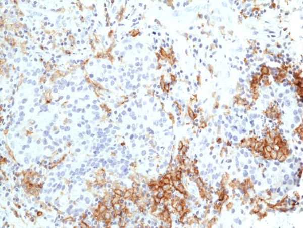 TIM-3 Antibody in Immunohistochemistry (Paraffin) (IHC (P))