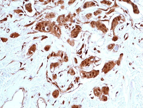 STAT3 Antibody in Immunohistochemistry (Paraffin) (IHC (P))