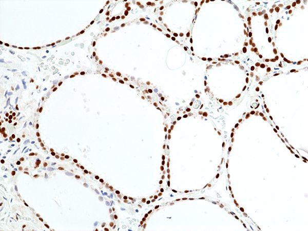 SMARCB1 Antibody in Immunohistochemistry (Paraffin) (IHC (P))