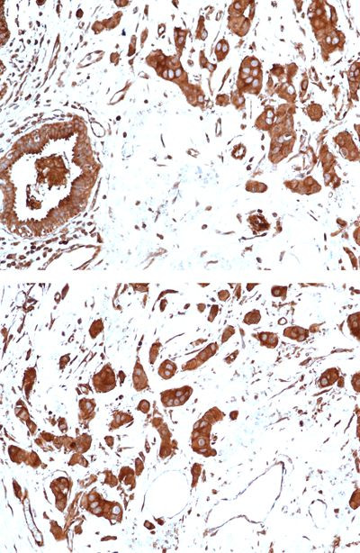 FAK Antibody in Immunohistochemistry (Paraffin) (IHC (P))