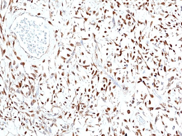 STAT6 Antibody in Immunohistochemistry (Paraffin) (IHC (P))
