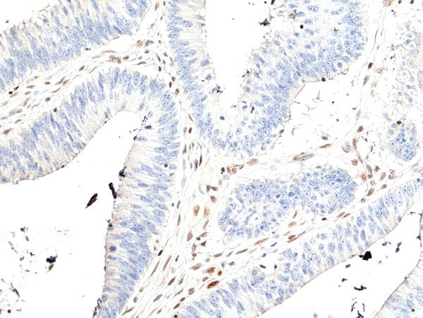MSH2 Antibody in Immunohistochemistry (Paraffin) (IHC (P))
