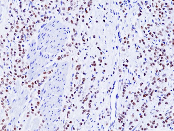 GATA3 Antibody in Immunohistochemistry (Paraffin) (IHC (P))