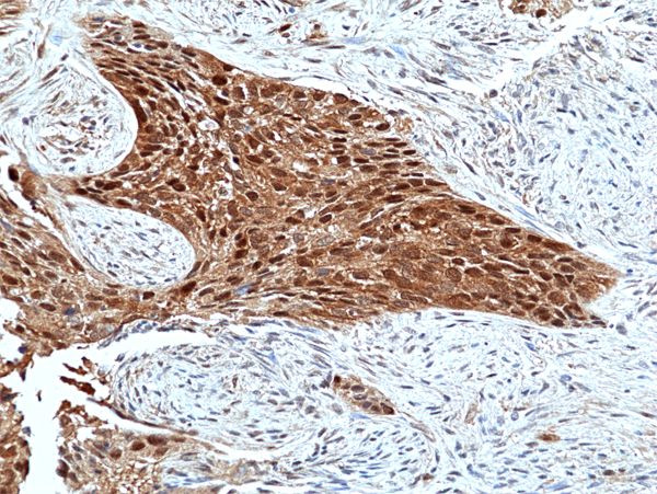 ERK2 Antibody in Immunohistochemistry (Paraffin) (IHC (P))