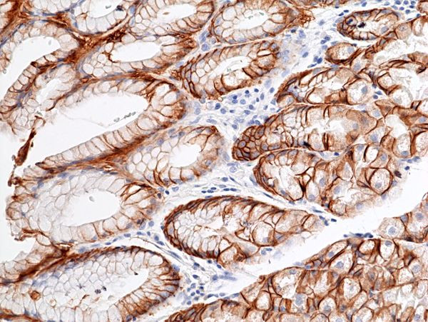 Carbonic Anhydrase IX Antibody in Immunohistochemistry (Paraffin) (IHC (P))