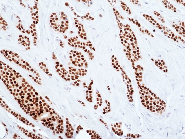 Estrogen Receptor alpha Antibody in Immunohistochemistry (Paraffin) (IHC (P))