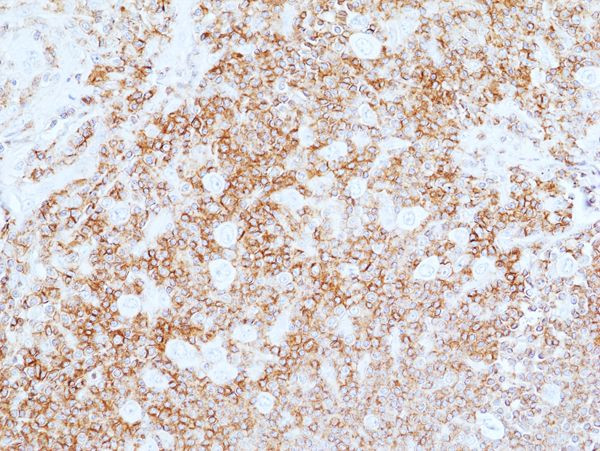 CD45 Antibody in Immunohistochemistry (Paraffin) (IHC (P))