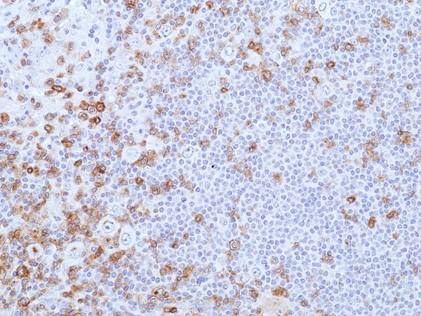 CD27 Antibody in Immunohistochemistry (Paraffin) (IHC (P))