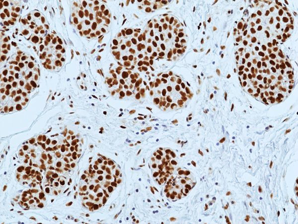 DNA-PK Antibody in Immunohistochemistry (Paraffin) (IHC (P))
