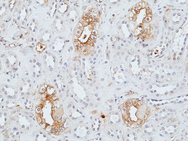 UPK2 Antibody in Immunohistochemistry (Paraffin) (IHC (P))
