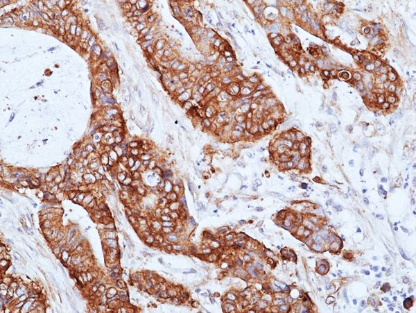 CD155 Antibody in Immunohistochemistry (Paraffin) (IHC (P))